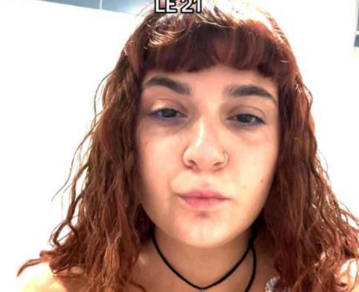 Marzia Sardo, la ragazza molestata durante una tac